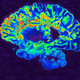 An MRI brain scan.